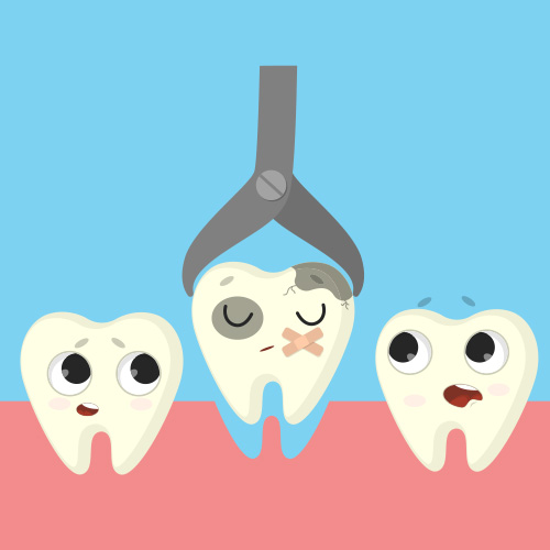 Tooth Extraction in Woodbridge, VA - Golden Pediatric Dentistry &  Orthodontics